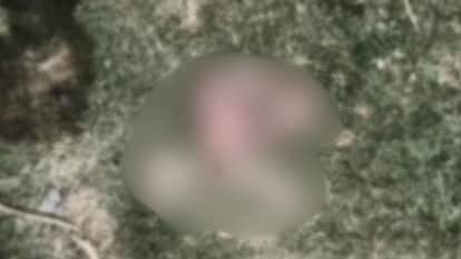 Bihar news : Newborn body in DMCH drain eaten by dogs