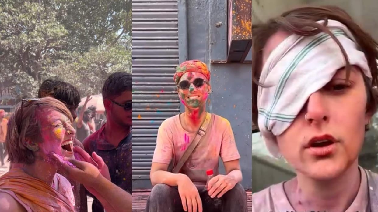 Austrian woman eye injury shares her experience after playing holi in vrindavan video goes viral