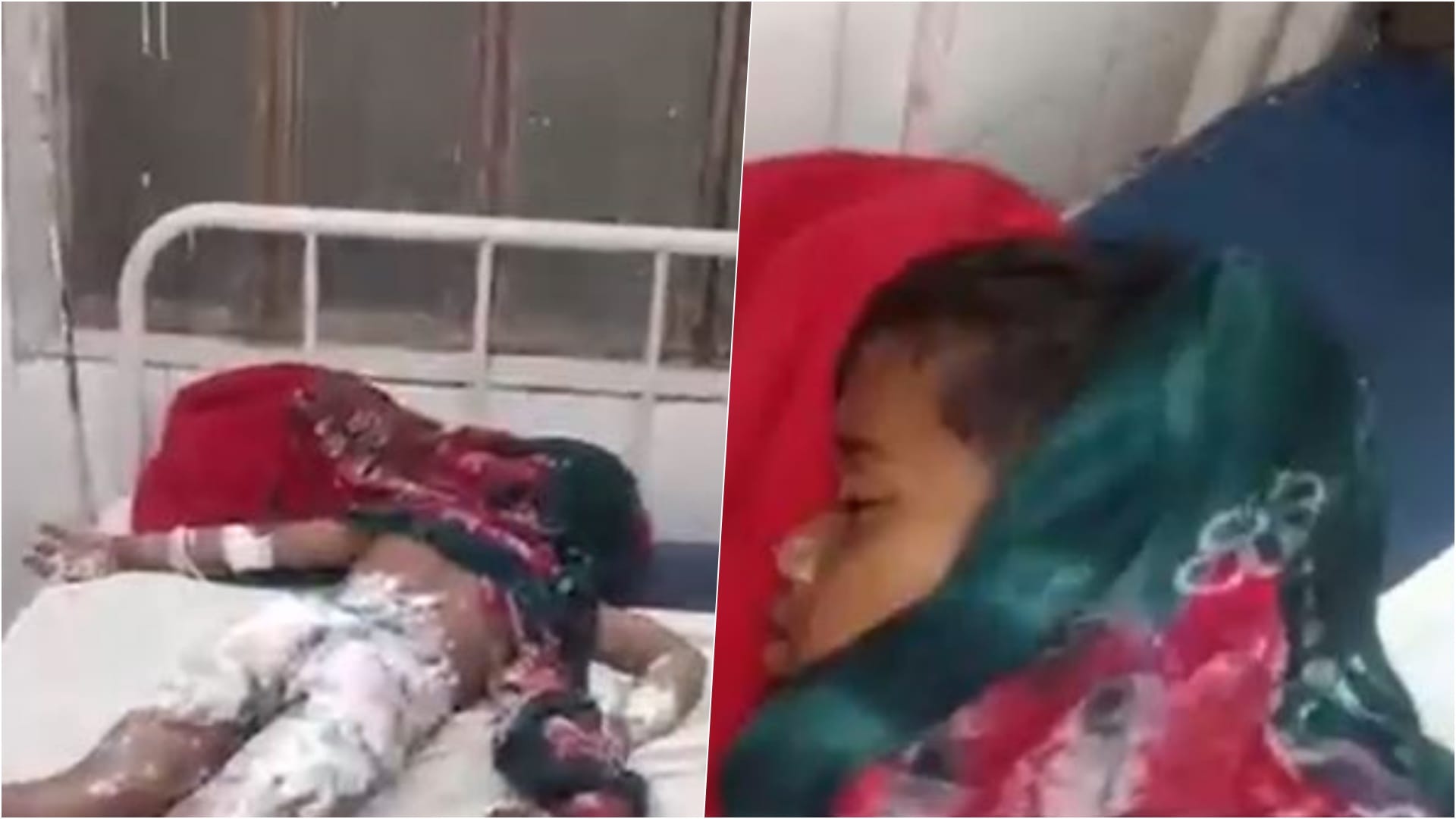 गर्म दूध में गिरा मासूम, गंभीर घायल