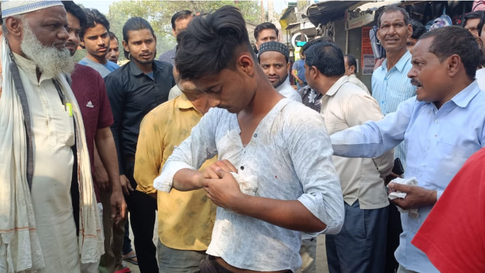 Kanpur: drug addict bit a shopkeeper's finger over a dispute of two rupees