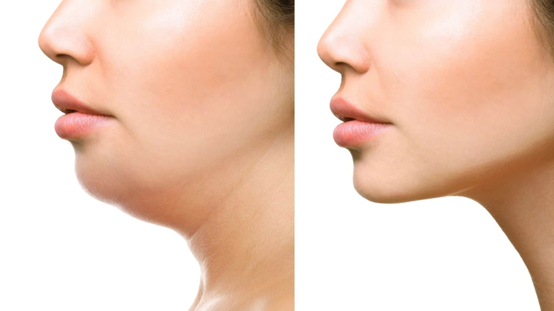 Lose Face Fat Naturally: 4 Best Face Yoga Exercises for a Chiseled Jawline and Younger Look