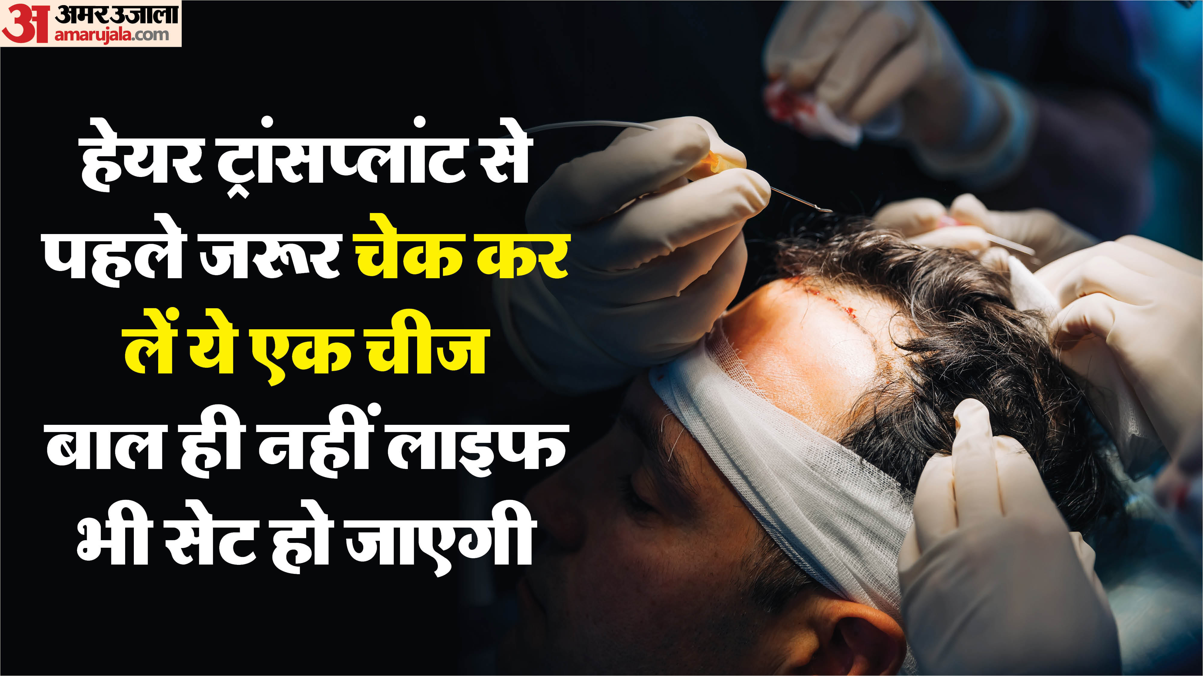 हेयर ट्रांसप्लांट