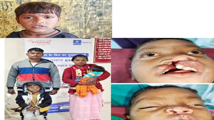 CG News: चिरायु योजना से बदली नन्हे विक्रम की जिंदगी, जन्मजात समस्या के ऑपरेशन के बाद लौटी मुस्कान