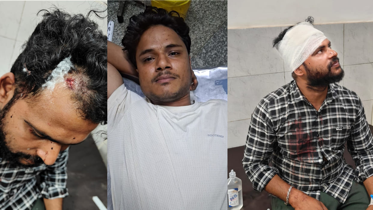 Two youths were shot by miscreants near the zoo in Gorakhpur; they were admitted to BRD.