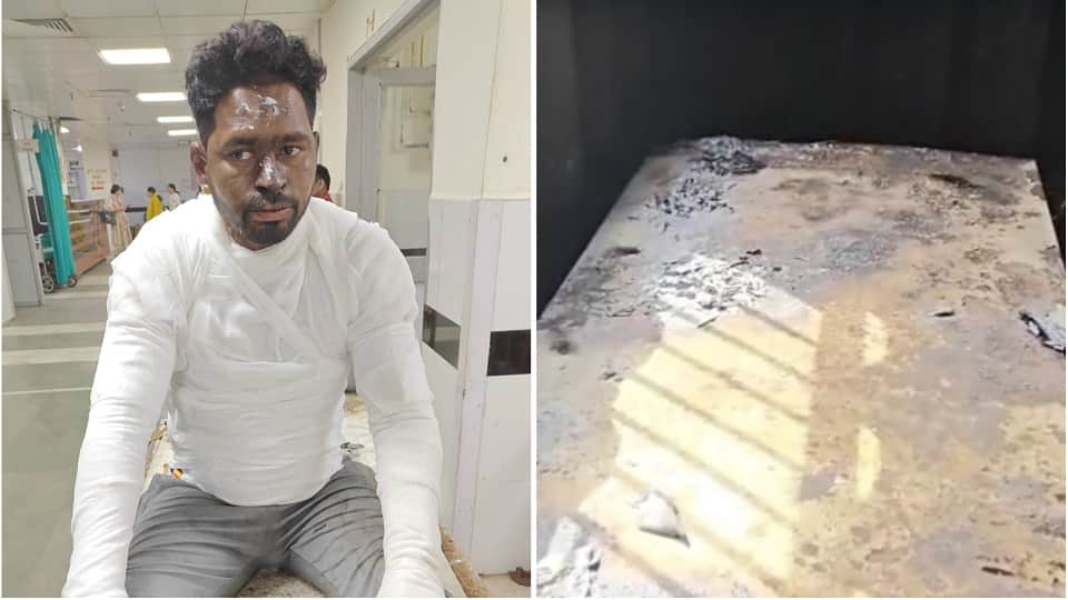 आग लगने से झुलसा युवक