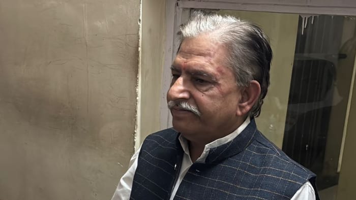 Farooq Abdullah Attack case Accused Kamal has also contested the councilor election