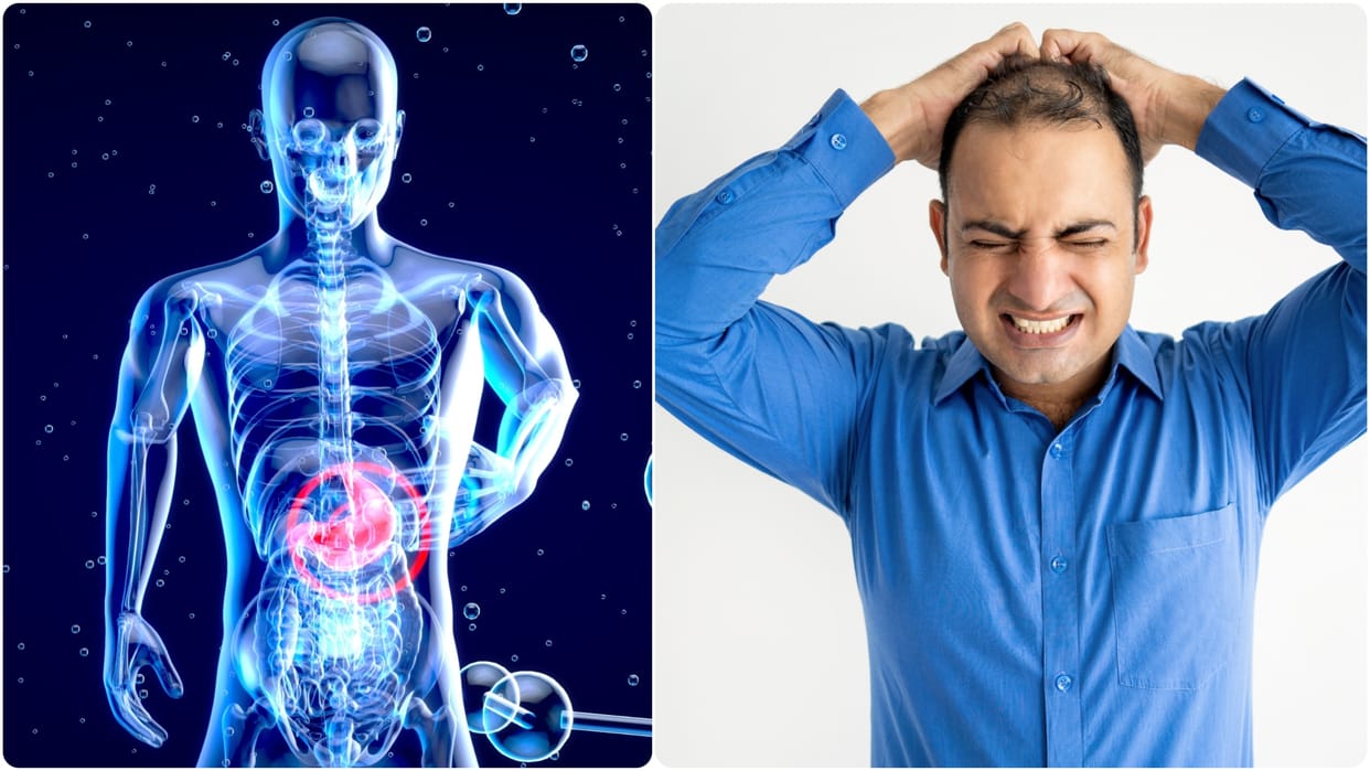 why my hair is falling so much poor gut health may cause hair loss among Indian men
