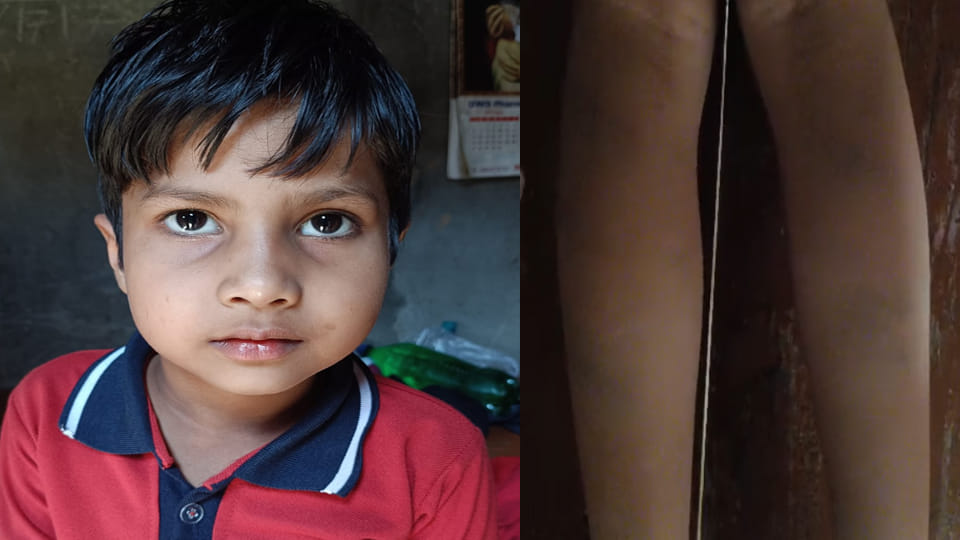 Kannauj: Class 1 Student Beaten for Failing to Recite Multiplication Tables; Family Outraged