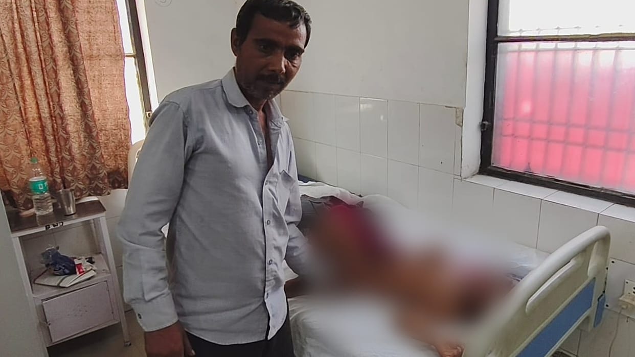 Four people suffer burns after pressure cooker explodes while cooking in Bareilly