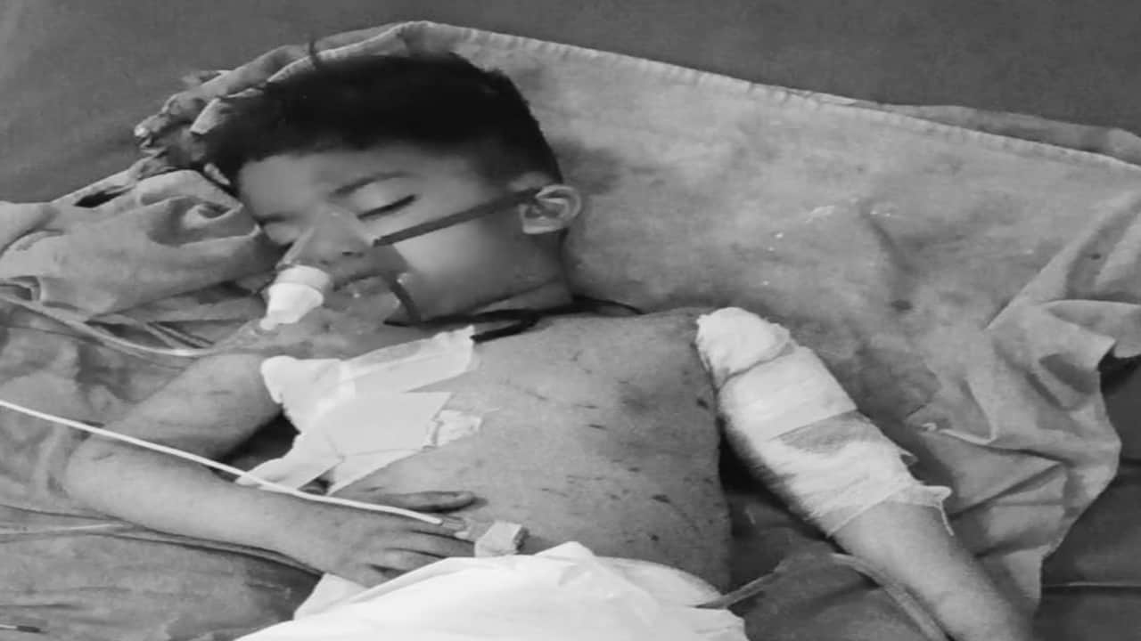 अस्पताल में भर्ती मासूम बच्चा