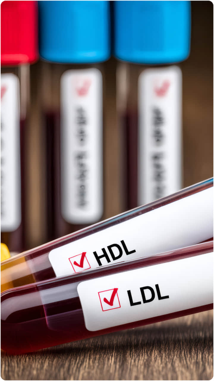 कोलेस्ट्रॉल