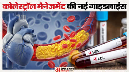 american heart association cholesterol new guidelines 2026 how to manage Lipids, Cholesterol