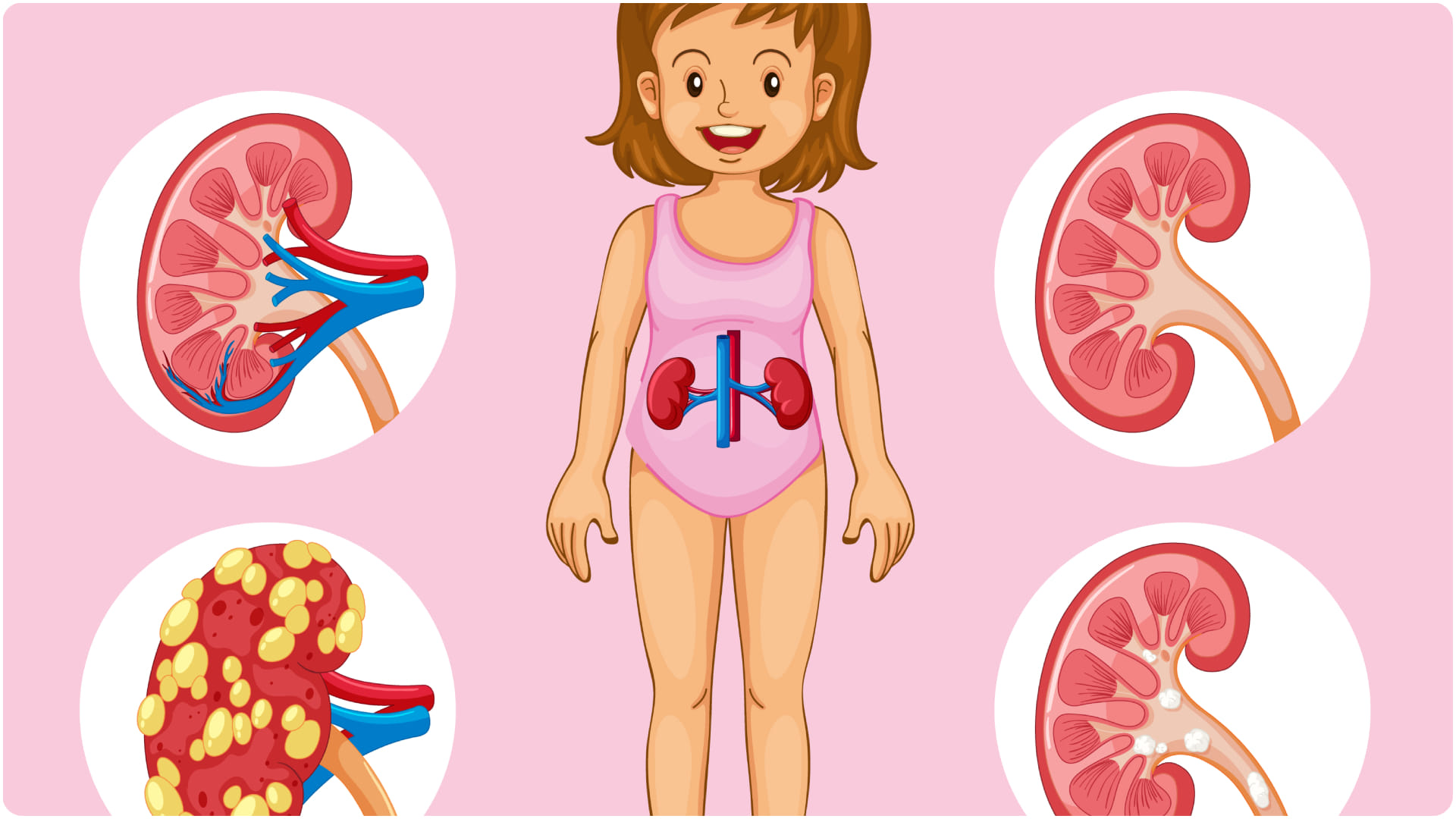 kidney disease and kidney failure risk in children know baccho me kidney ki bimari