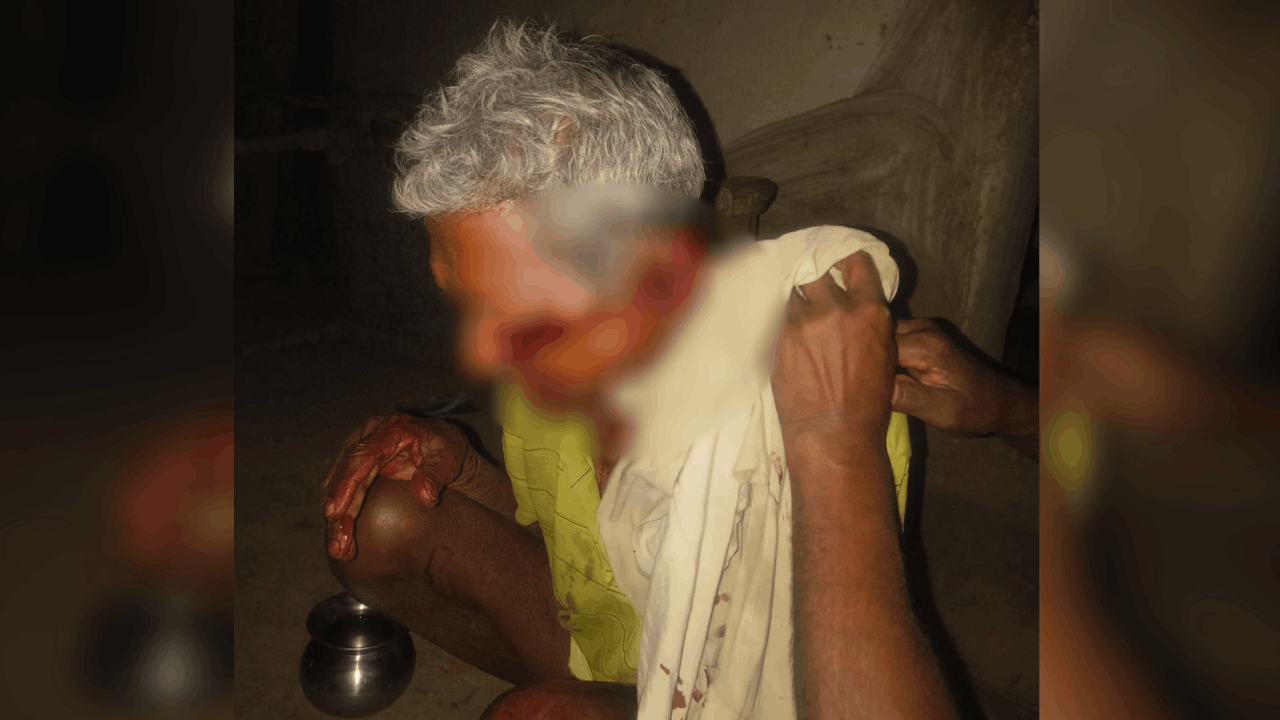 बुजुर्ग की आंख में लगी चोट