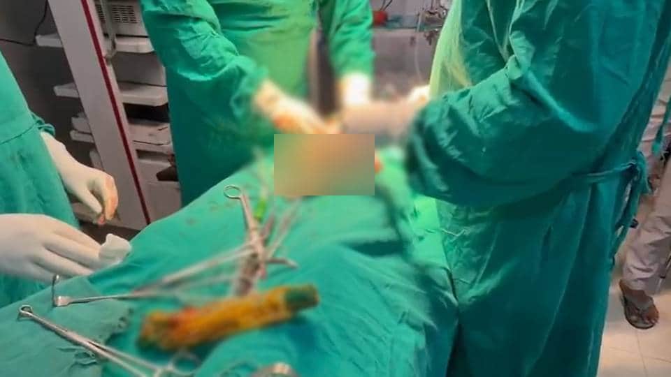 डॉक्टरों ने ऑपरेशन करके पेट से निकाली बोतल।