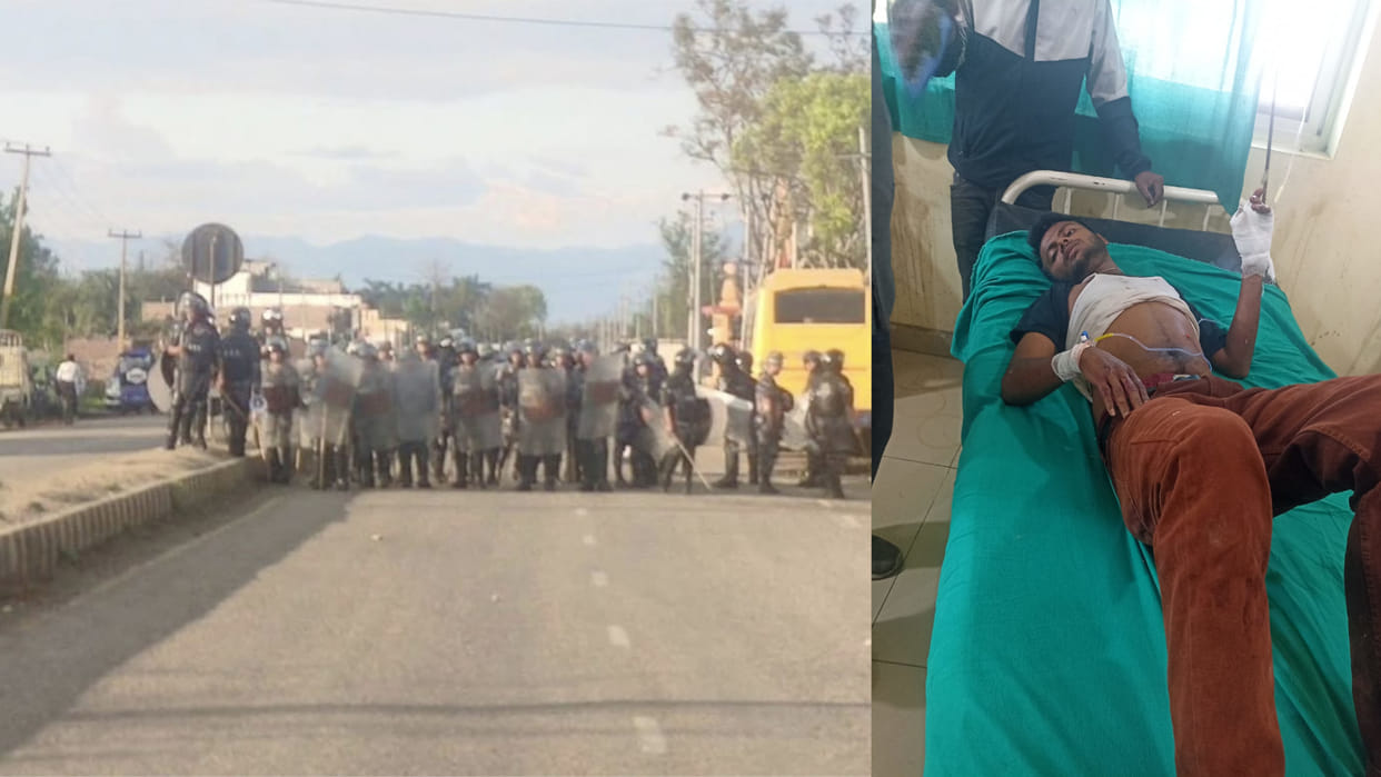 Eid riots in Nepal's Kapilvastu; 5 injured in police firing Siddharthnagar hindi News