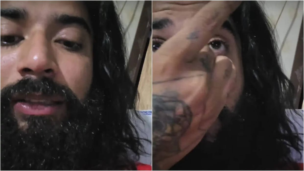 Anurag Dobhal share video from hospital say thanks to fans for love