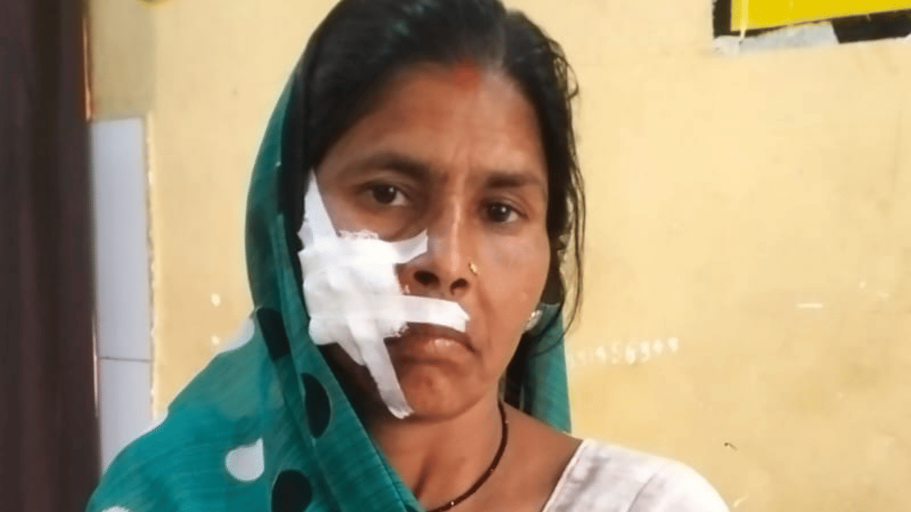 हमले में घायल हुई महिला।