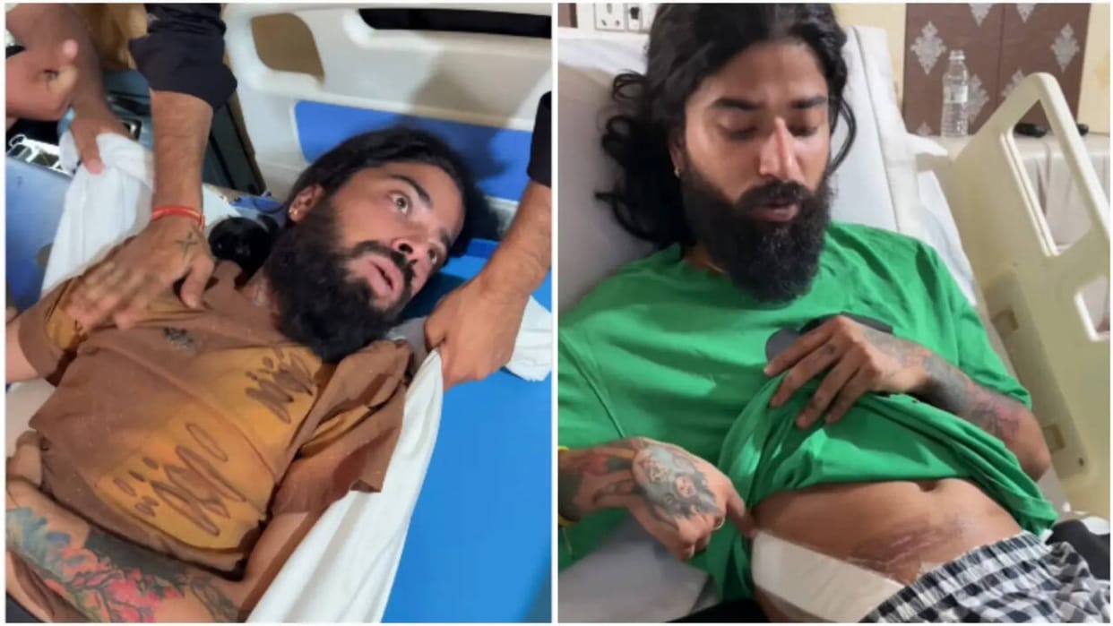 Anurag Dobhal health update he is in Unbearable Pain Right Leg Is Numb