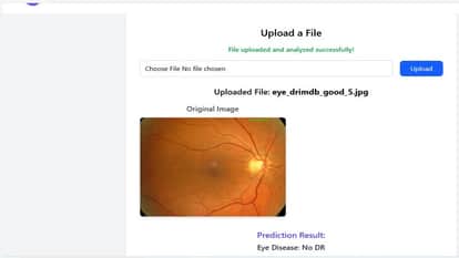 AI Breakthrough: Nidan AI Detects Diseases Early Using MRI and Retina Scans