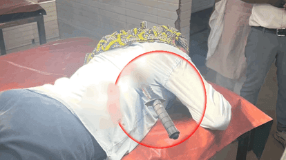 Nurse attacked with knife near Industry Minister and MP bungalow in Korba