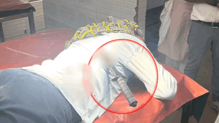 नर्स की पीठ में फंसा चाकू