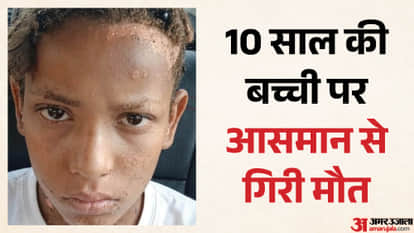 Girl scorched by HT line current succumbs to injuries