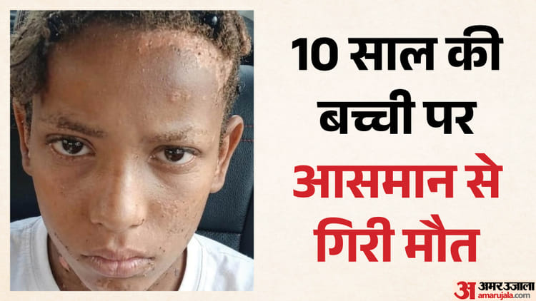 कंडेंसर की पिन्नी बनी मौत का कारण: हाईटेंशन की चपेट में आई 10 साल की रुकैय्या, झुलसने से मौत; छत पर खेल रही थी