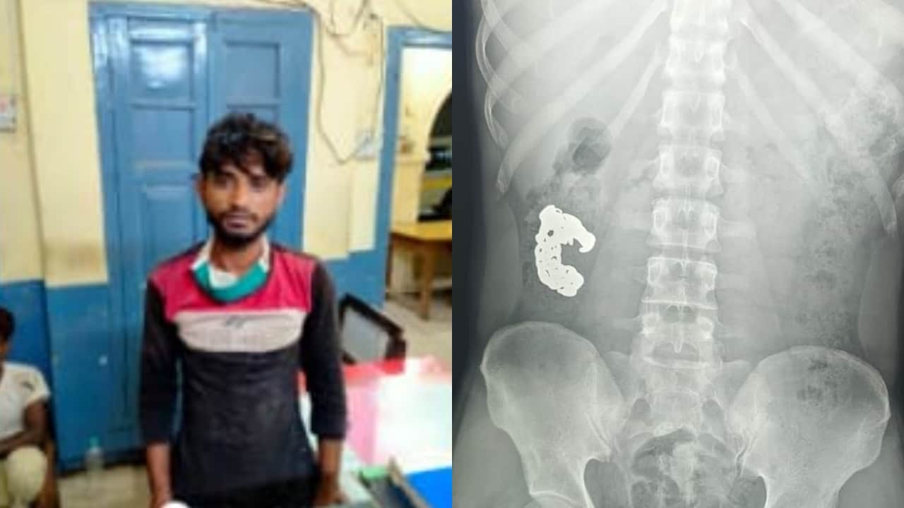 आरोपी सिकंदर ने निगला चोरी का ब्रेसलेट