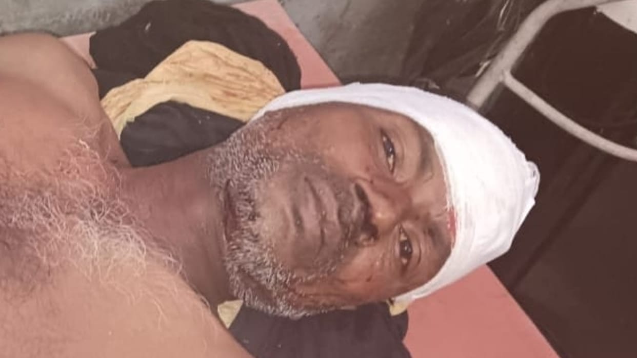 Tiger Attacks a Villager in Pilibhit
