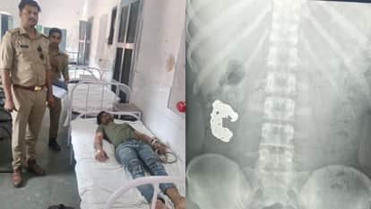 Thief Swallows Silver Bracelet in Bareilly Police Adopt This Method for Recovery