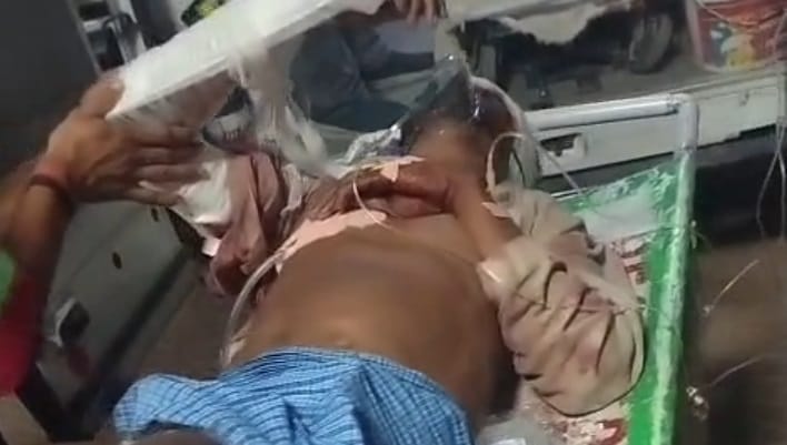 Orai Elderly Man Beaten Half to Death with Sticks Then Run Over by a Car Case Registered Against Miscreants