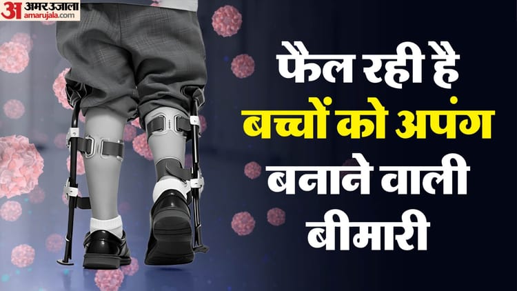 Alert: मम्प्स-मीजल्स के बाद अब नई आफत, बच्चों को जीवनभर के लिए लकवाग्रस्त बनाने वाली बीमारी का अलर्ट