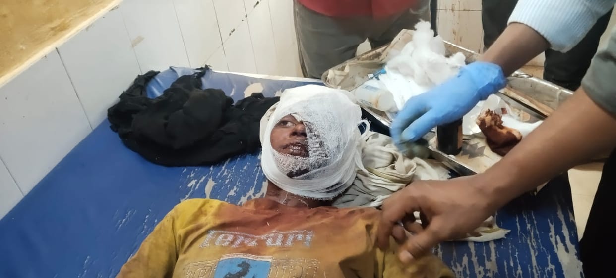 Bahraich: A tiger coming out of the forest scratched the boy's eye, his condition is critical.