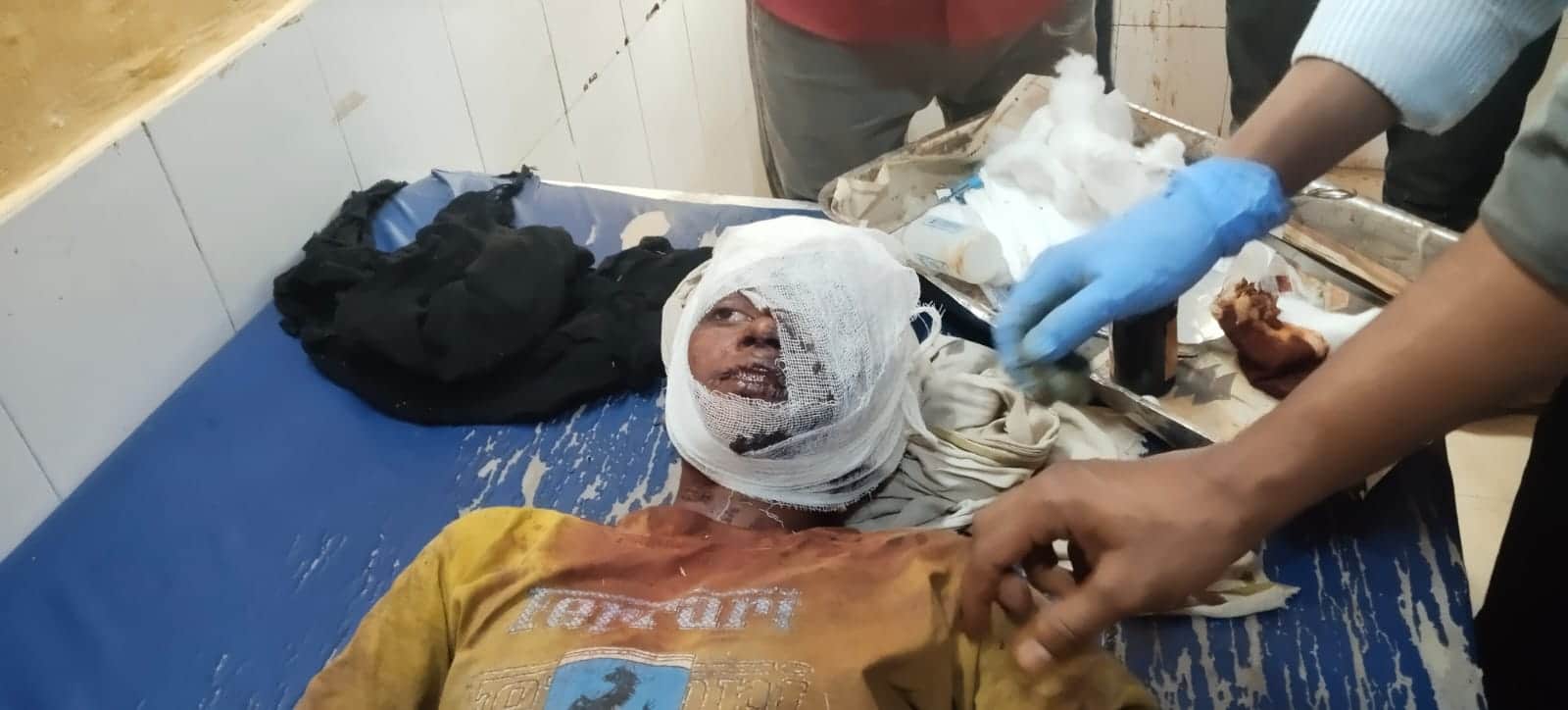 हमले में घायल हुआ बालक।