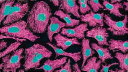 Not every lump means cancer; clear and accurate communication is the first step to better treatment.