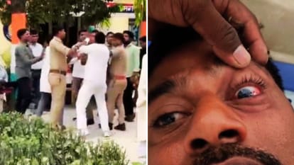 मारपीट की वीडियो वायरल और आंख में लगी चोट को दिखाता शिकायतकर्ता।