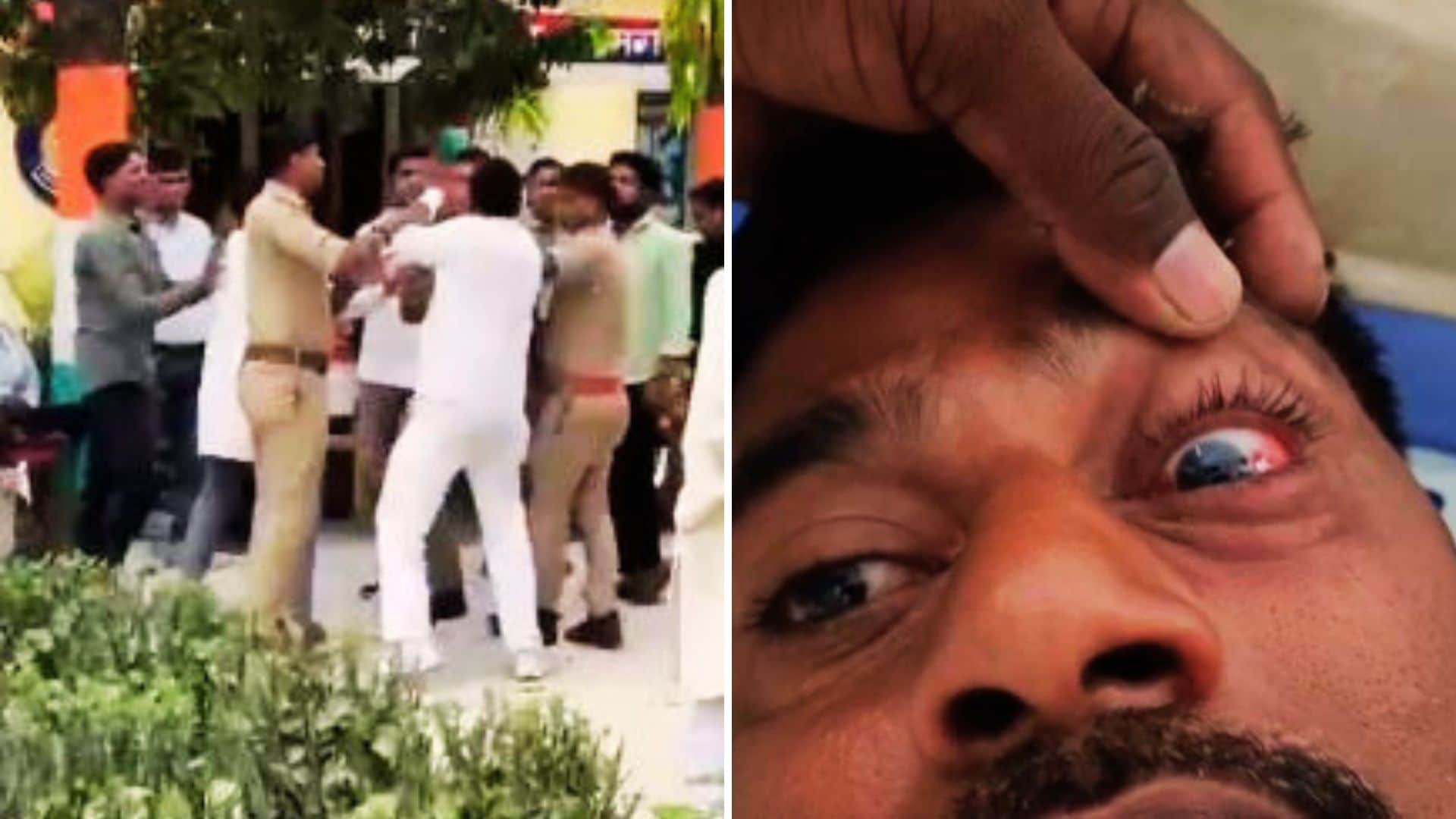 मारपीट की वीडियो वायरल और आंख में लगी चोट को दिखाता शिकायतकर्ता।