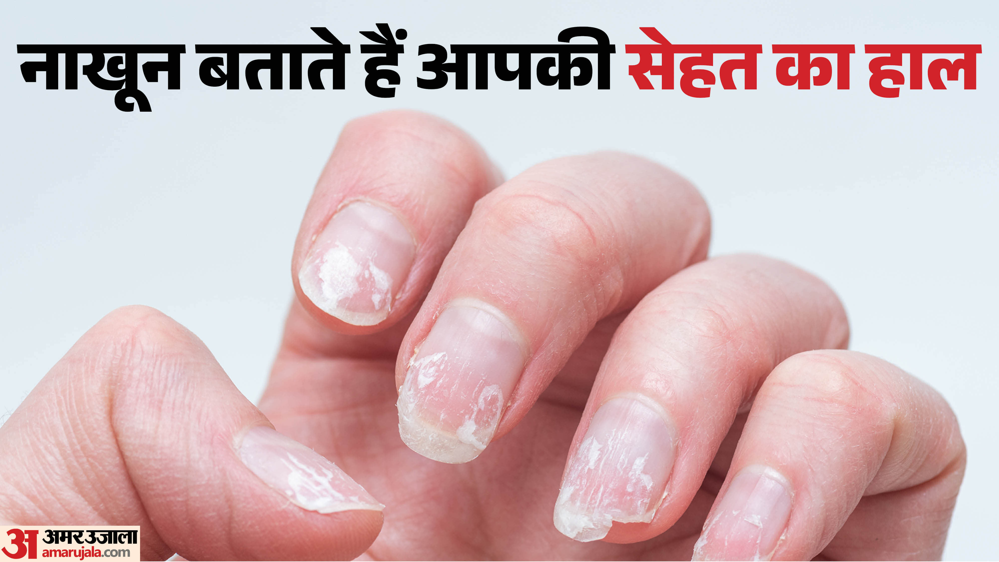 नाखून बताते हैं आपकी सेहत का हाल