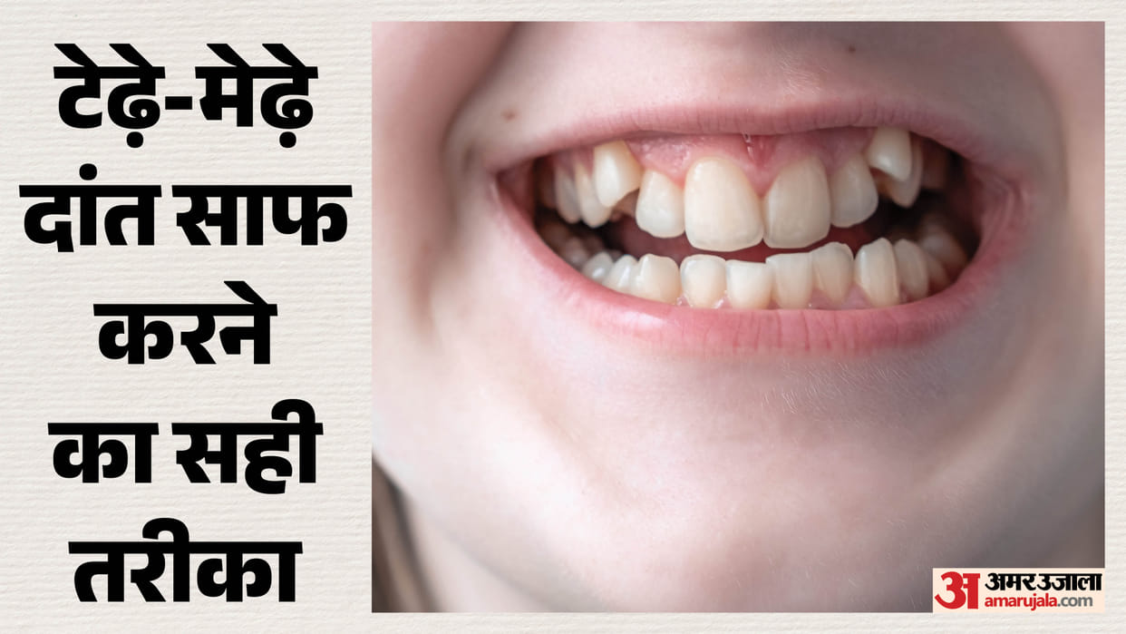 right way to brush Crooked Teeth in hindi tede mede dant me brush kaise kare