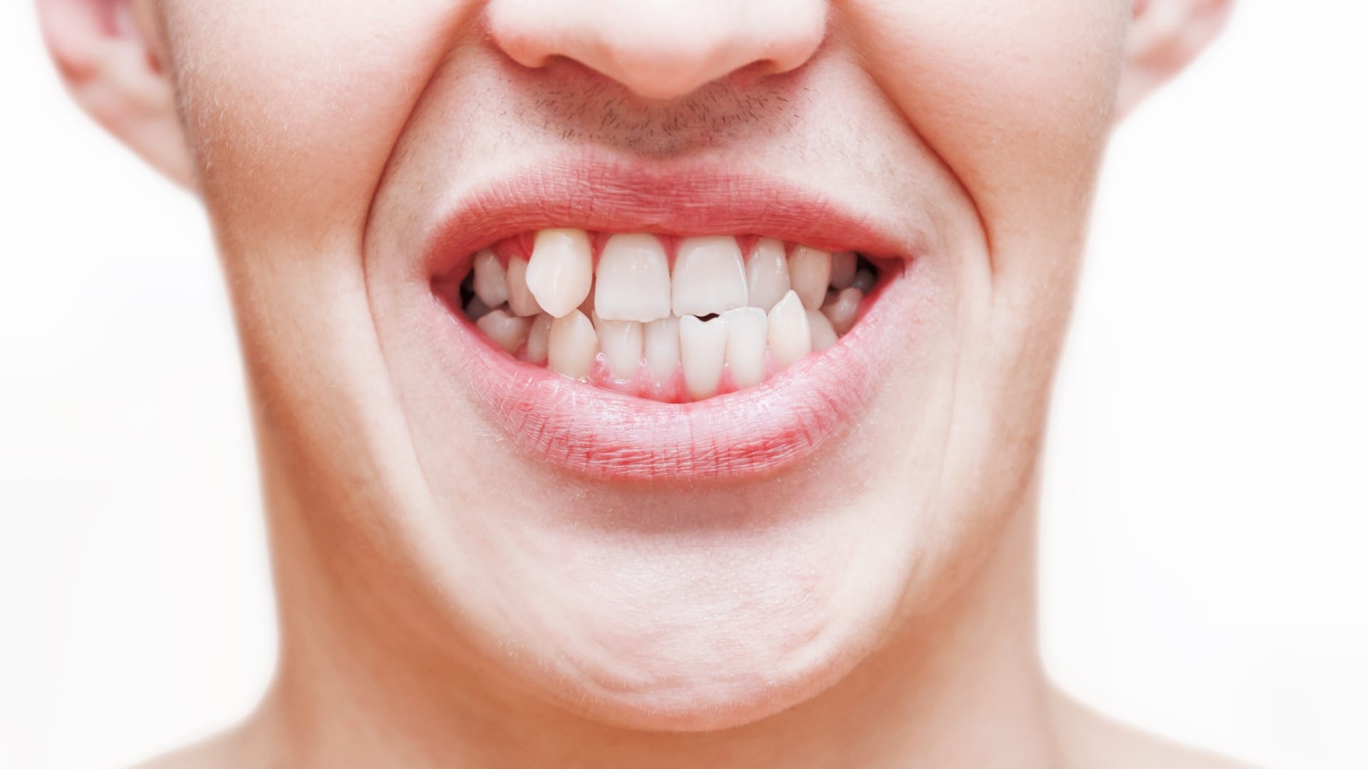 right way to brush Crooked Teeth in hindi tede mede dant me brush kaise kare
