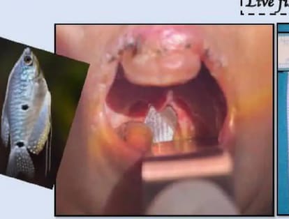 Indore: During cleaning, a fish jumped out of the aquarium and got stuck in the throat of a one-year-old child