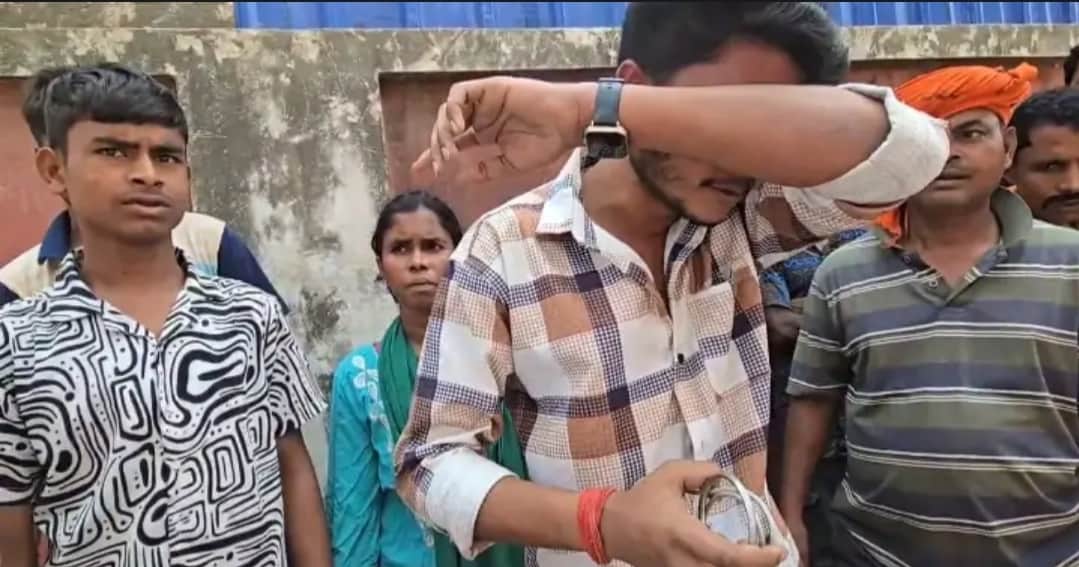 हाथ से चेहरा छिपाता युवक