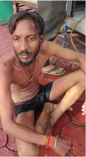 Bhopal News: Trader Sets Himself on Fire Amidst Anti-Encroachment Drive; Allegations of Selective Action Again