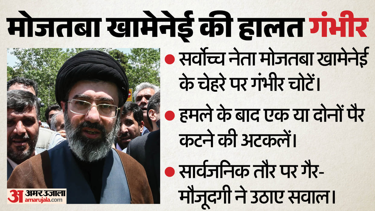 Iran supreme leader Mojtaba Khamenei severe disfiguring wounds report claims amid US Iran Peace Talks