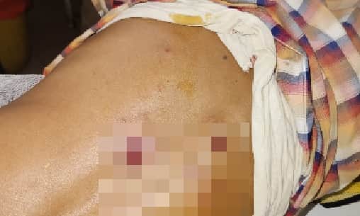 घर के पीछे शौच को गए अधेड़ को लगी गोली