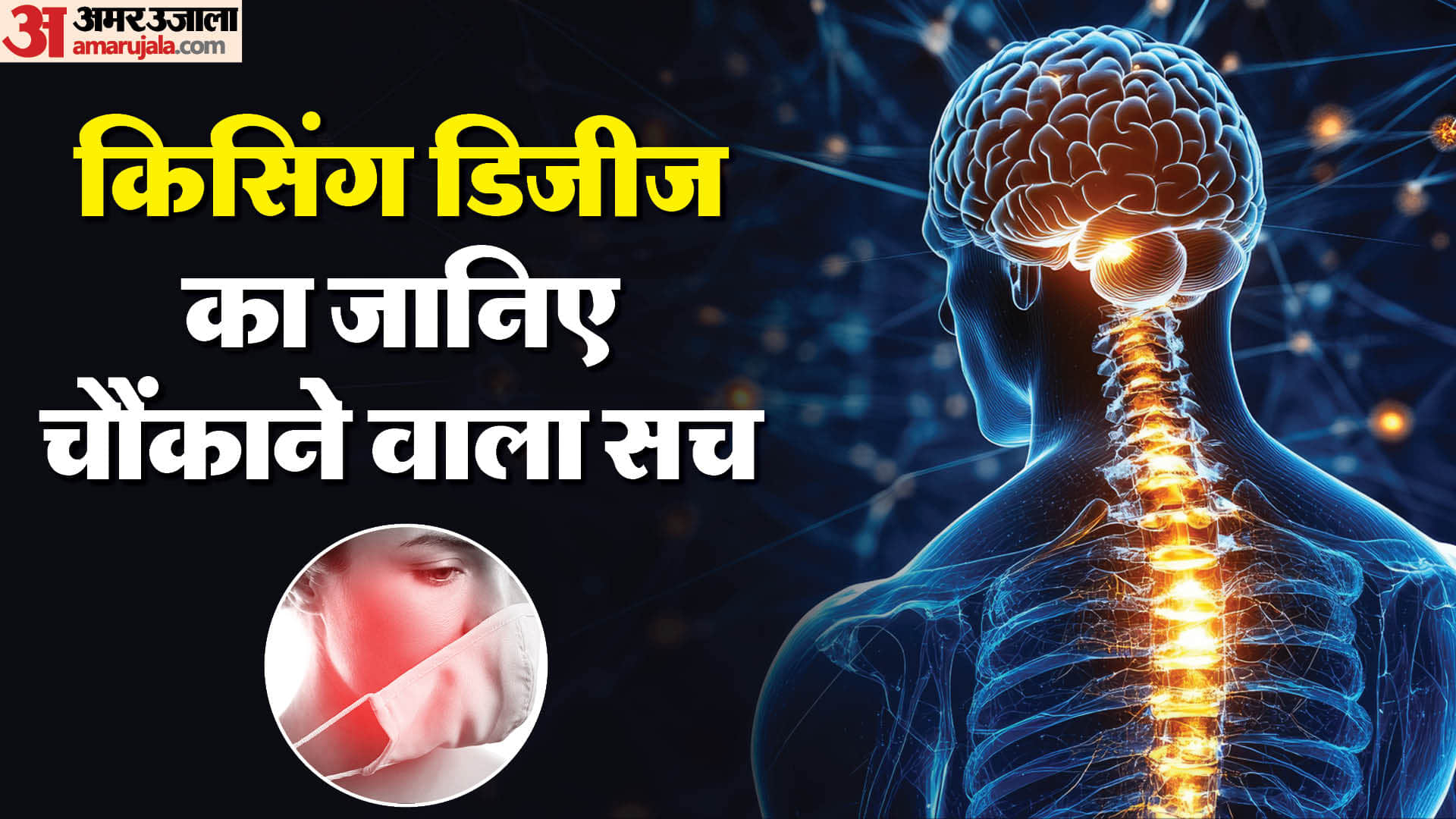 किसिंग डिजीज के बारे में जानते हैं आप?