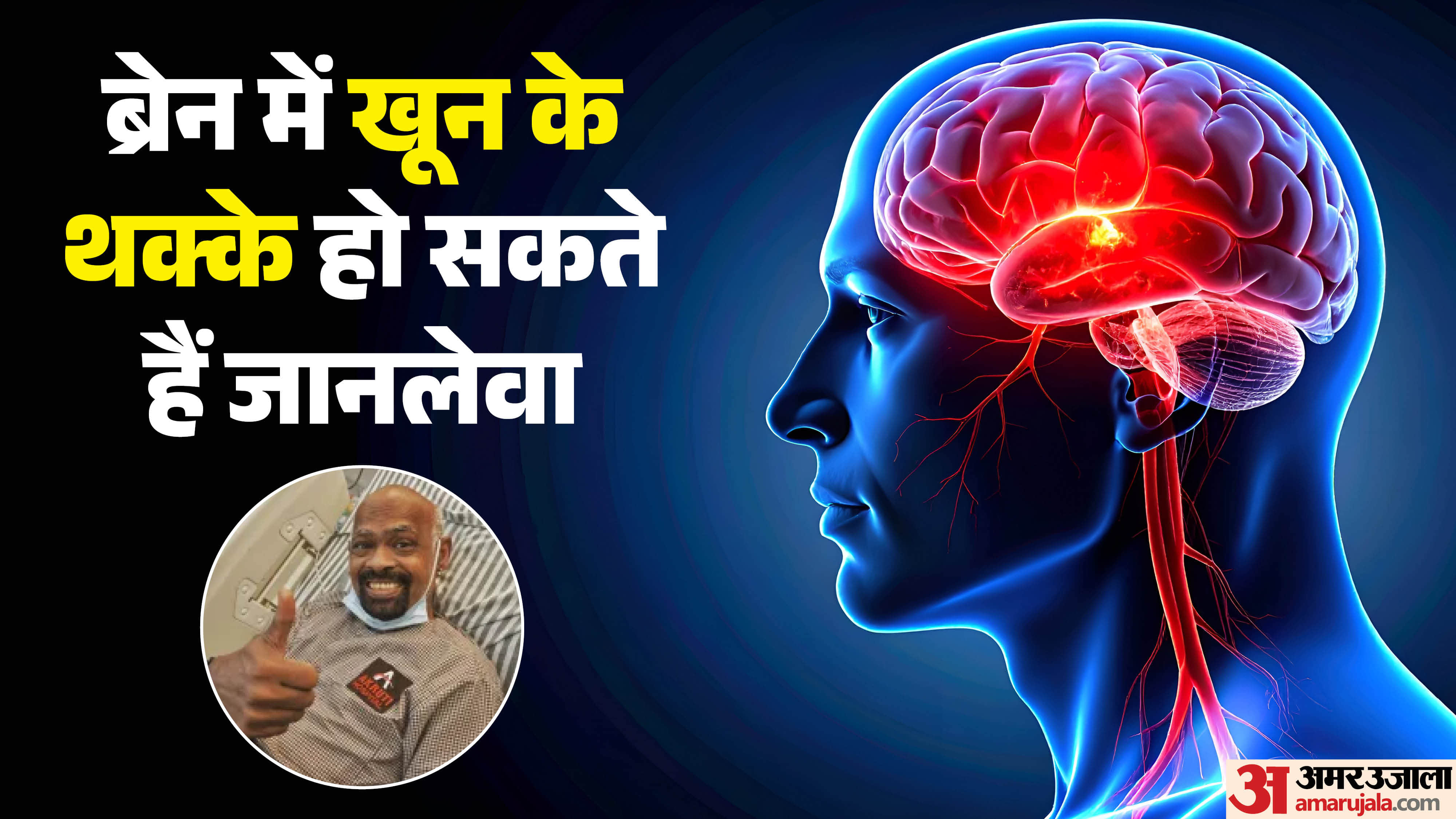 vinod kambli health update brain stroke risk what causes brain clotting know its causes and risk