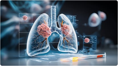 dupilumab injection for incurable lung disease Chronic Obstructive Pulmonary Disease COPD know details
