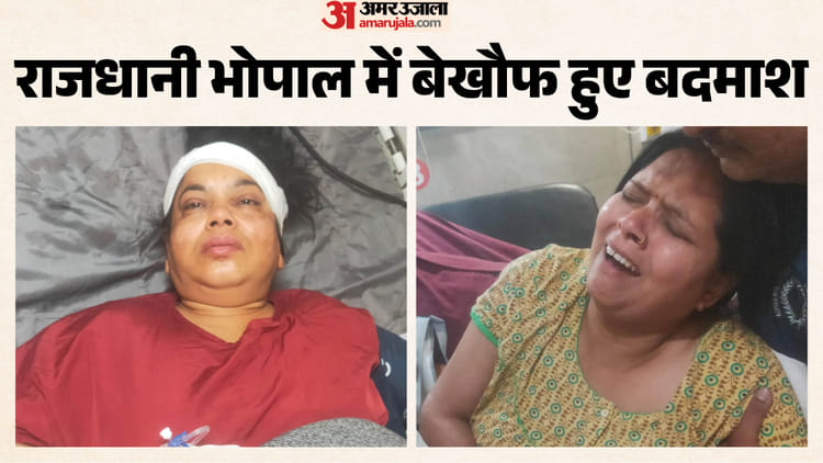 भोपाल में सनसनी: चलती स्कूटी से महिलाओं को गिराया, फिर पर्स लूटा और हो गए फरार; पुलिस जांच में जुटी